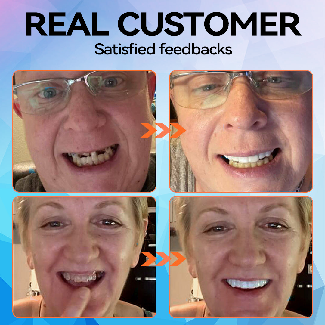 Official Store | Minceetbien™🗽 Moldable Dentures(⏰Limited Time 80% Off - Last 30 Minutes ⏰)