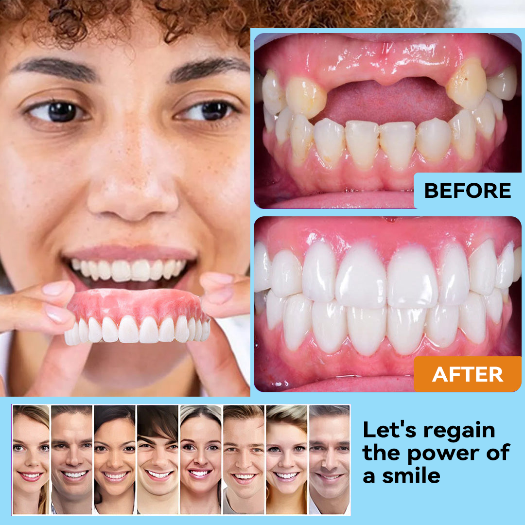 Official Store | Minceetbien™🗽 Moldable Dentures(⏰Limited Time 80% Off - Last 30 Minutes ⏰)