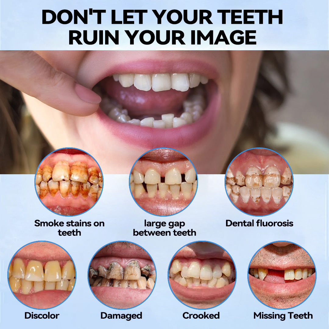 Official Store | Minceetbien™🗽 Moldable Dentures(⏰Limited Time 80% Off - Last 30 Minutes ⏰)