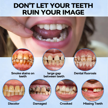 Official Store | Minceetbien™🗽 Moldable Dentures(⏰Limited Time 80% Off - Last 30 Minutes ⏰)